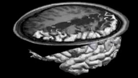Self come to mind Brain scanner image by Hanna Damasio